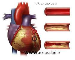 عروق کرونر